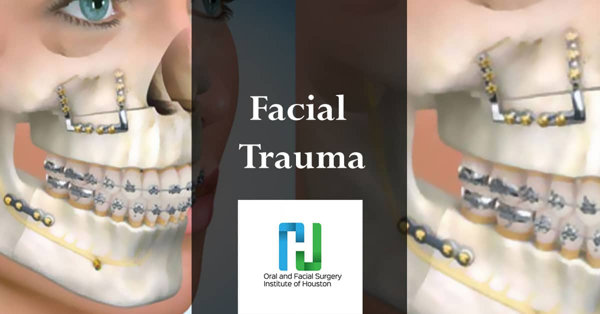 Complex facial trauma treatment Houston
