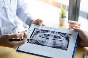 Image,Of,Doctor,Or,Dentist,Presenting,With,Tooth,X ray,Film