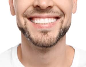 Man smiling after dental implant treatment in Houston, TX