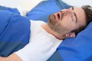 A man with sleep apnea lying on his back and snoring